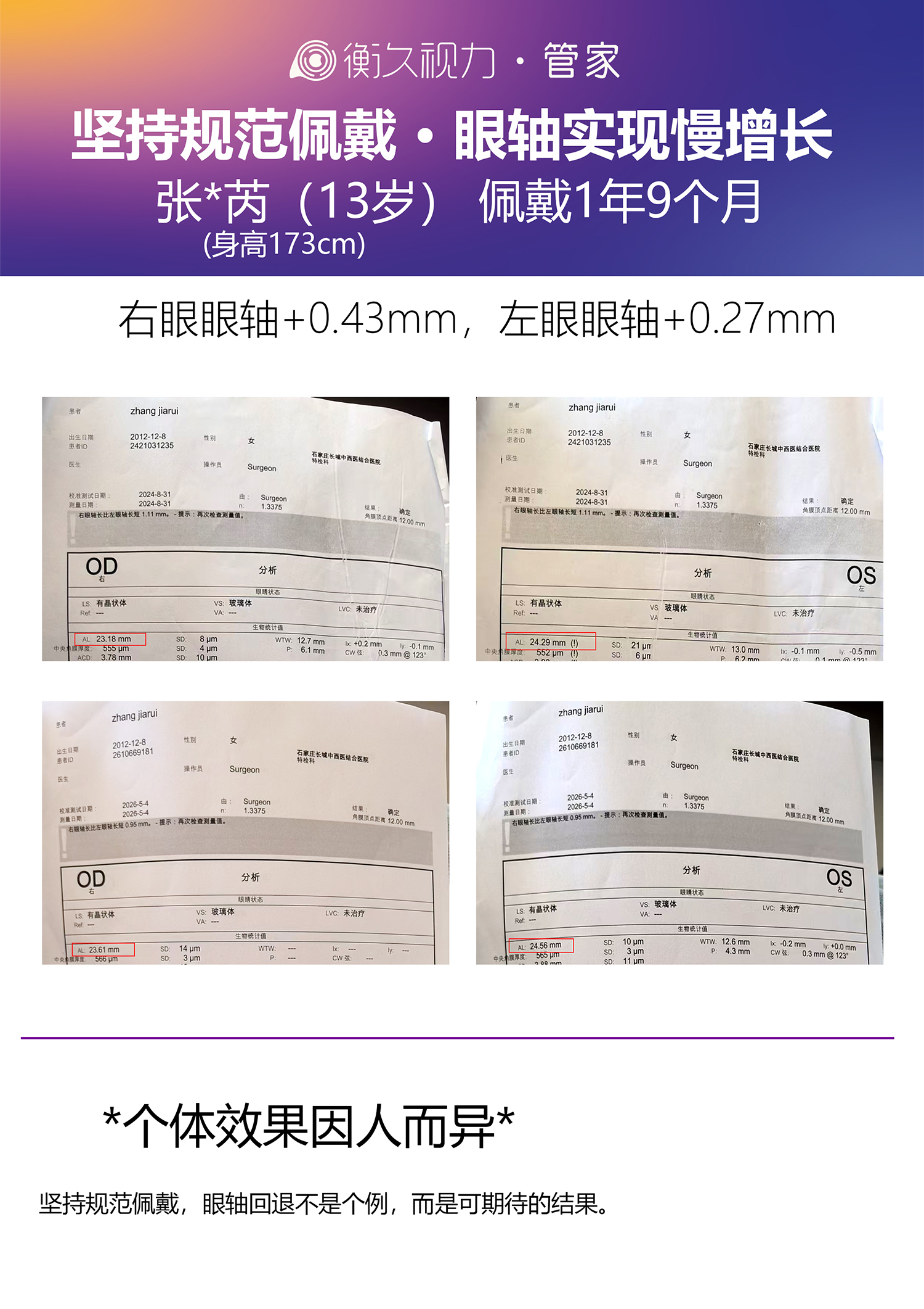 眼轴案例 03