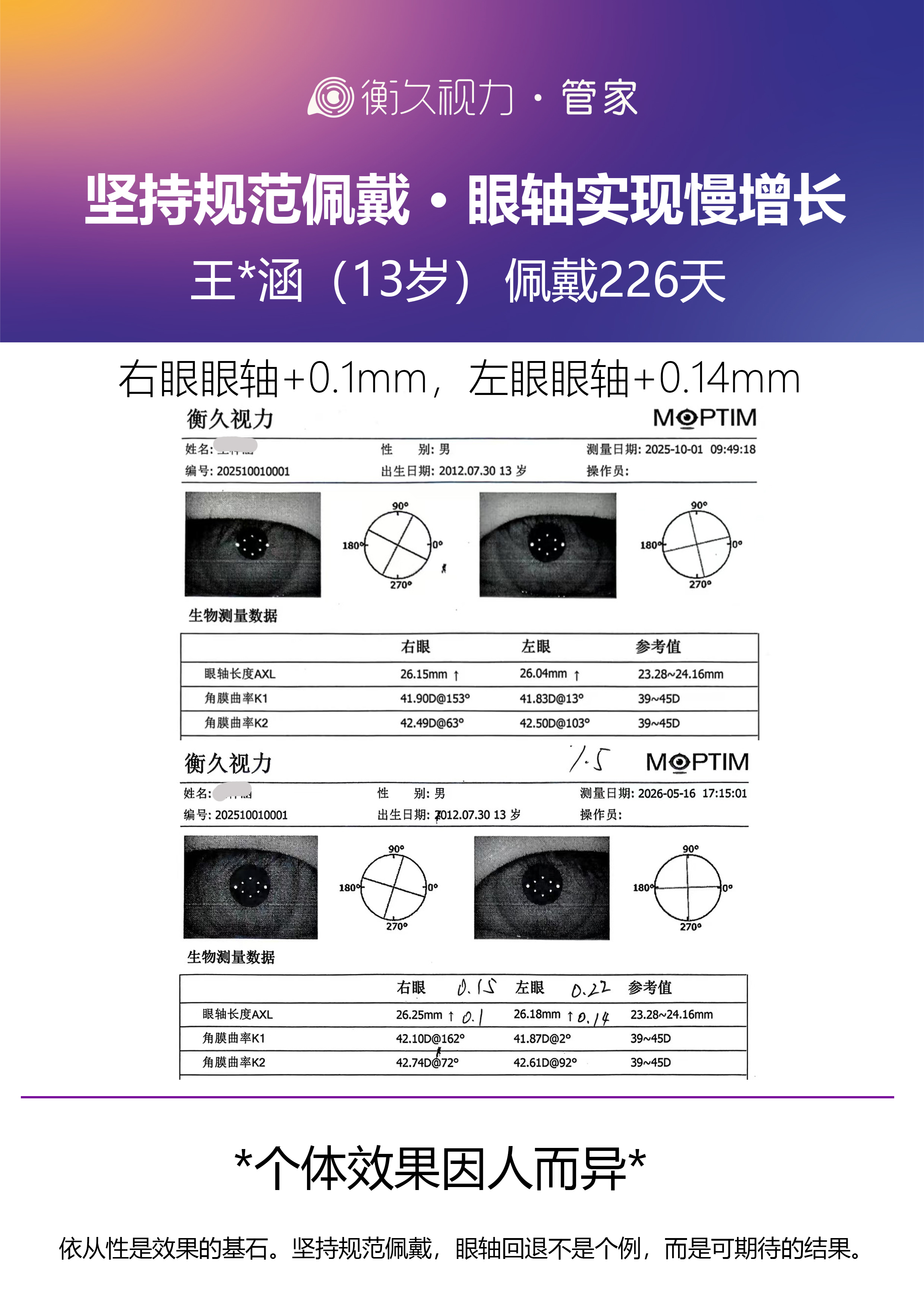 眼轴案例 07