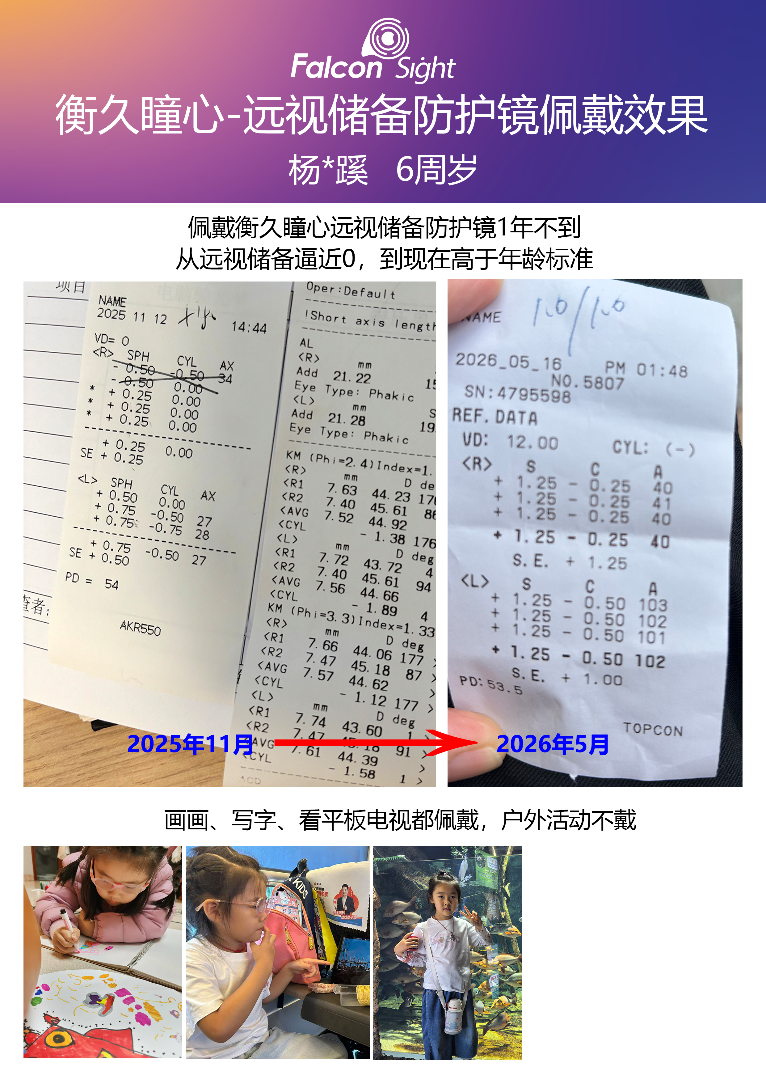 眼轴案例 10