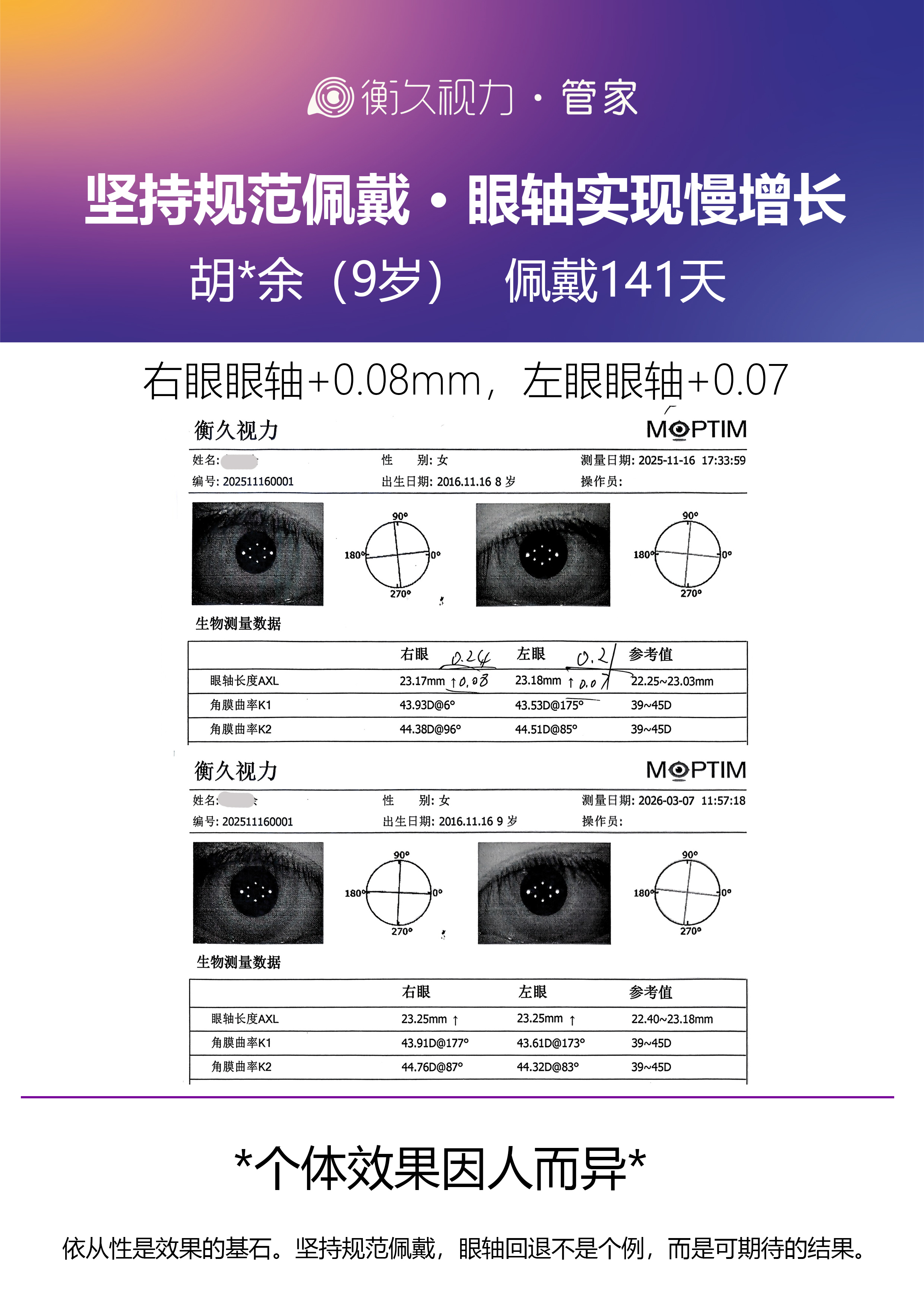 眼轴案例 12