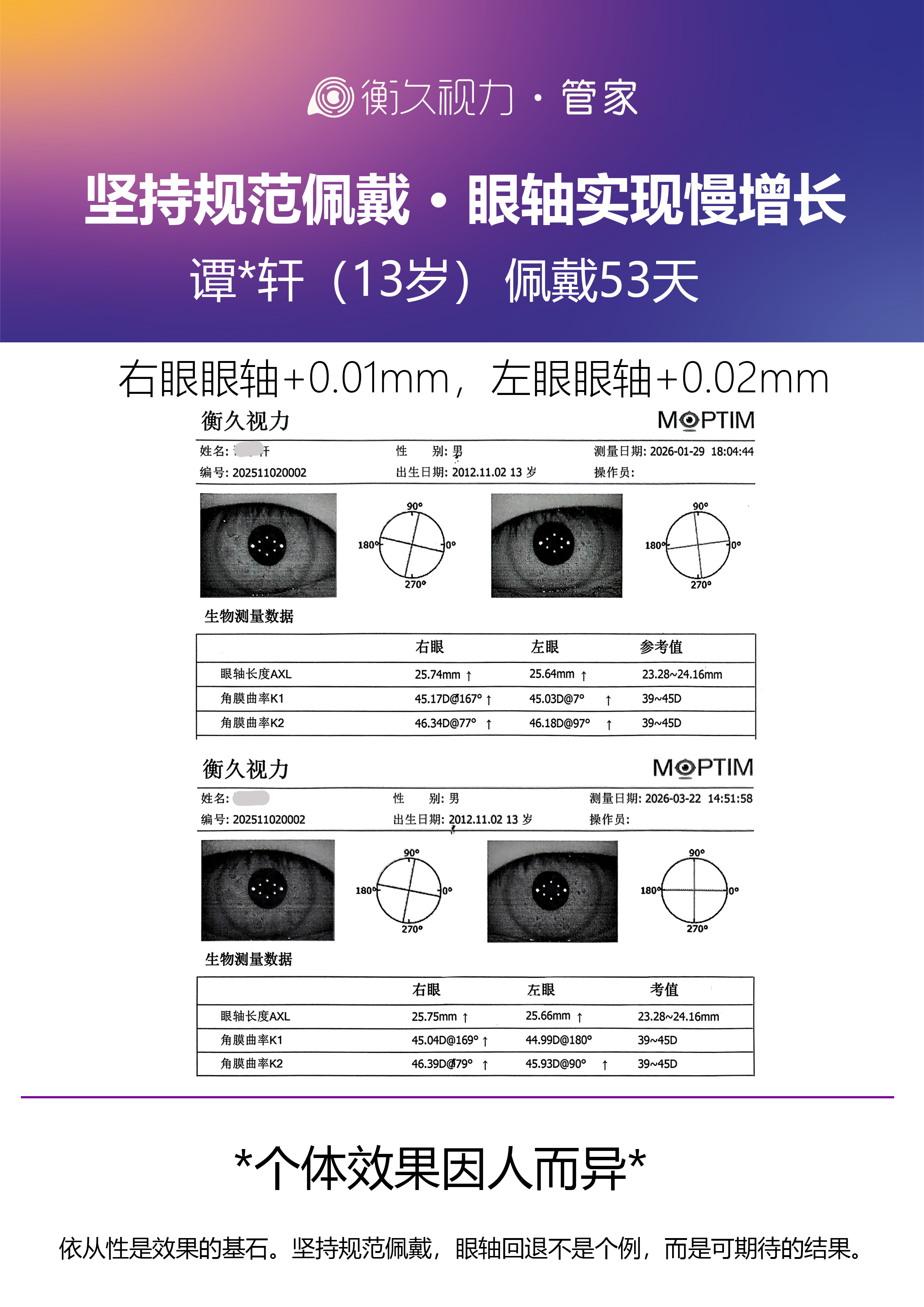 眼轴案例 13